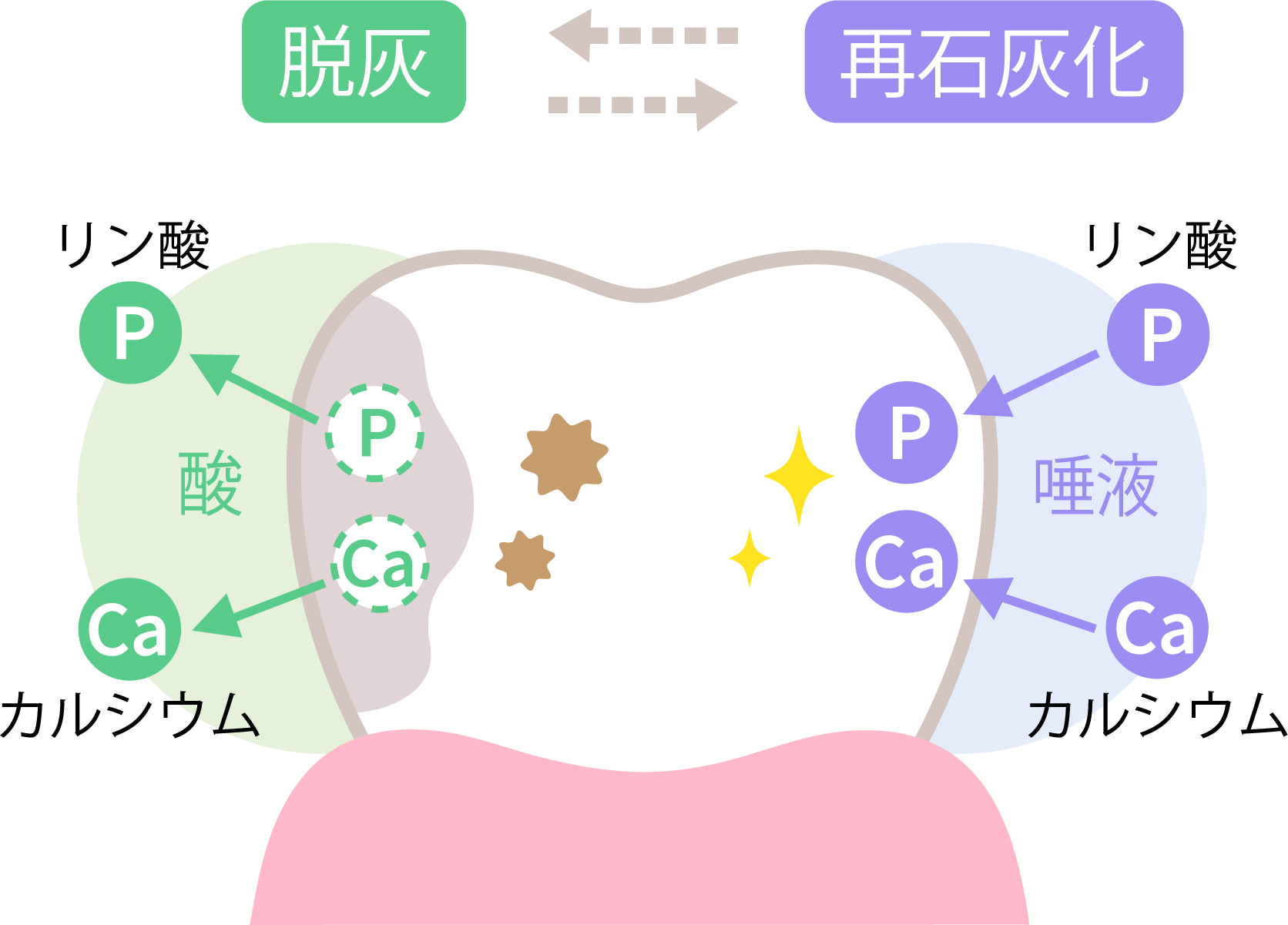 脱灰 再石灰化